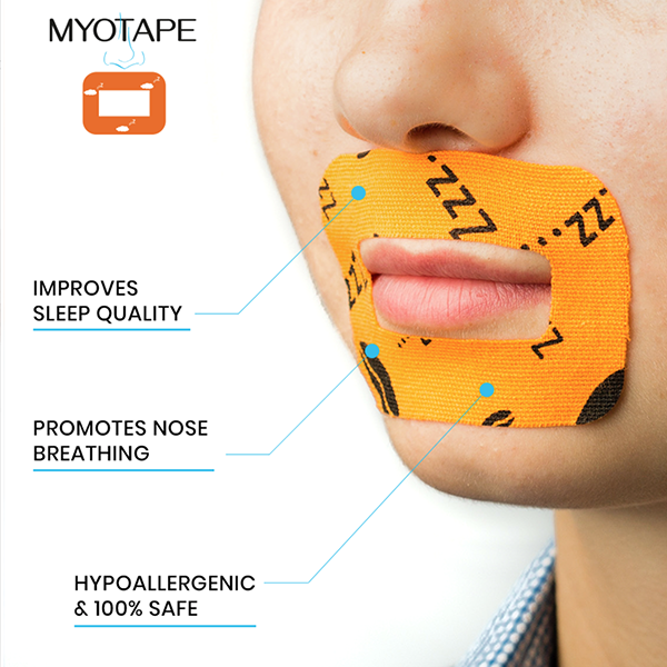 MYOTAPE – Preventive Orthodontics