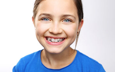 interceptive-orthodontics
