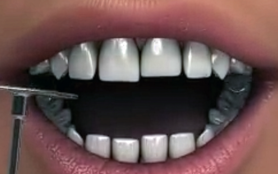 Cosmetic Dentist Johannesburg