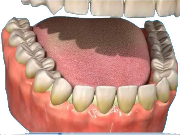 Stained Teeth