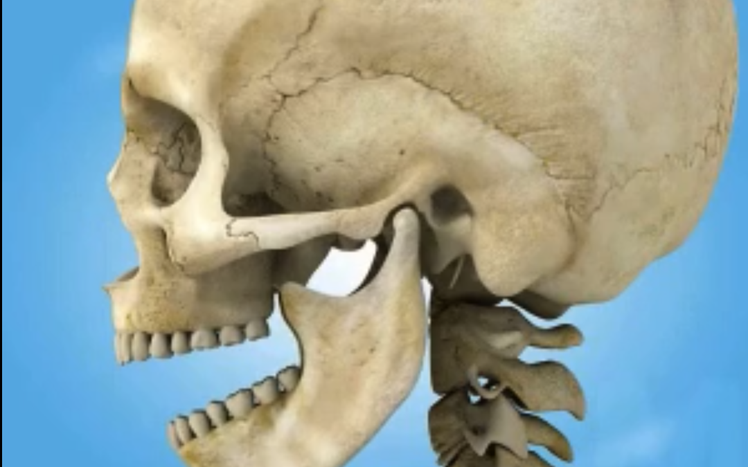 Temporomandibular joint dysfunction (TMJ)