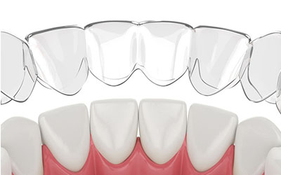 interceptive-orthodontics